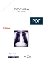 FOTO THORAK.pptx