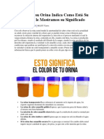 El Color de Su Orina Indica Como Está Su Salud