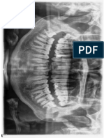 Informe Radiografico de Denticion Permanente