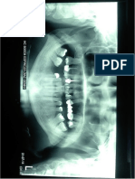 Informe Radiografico Denticion Permanente