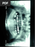 INFORME RADIOGRAFICO DENTICION PERMANENTE .docx