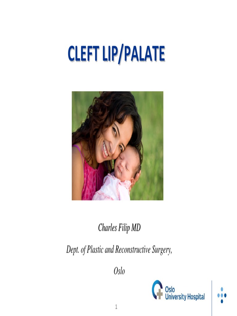 Cleft Lip and Palate Overview | PDF | Clinical Medicine | Face