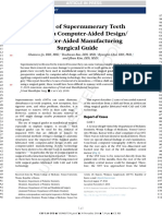 Removal of Supernumerary Teeth Utilizing A Computer-Aided Design/ Computer-Aided Manufacturing Surgical Guide