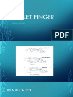 Mallet Finger: Surmila Apri Yulisa