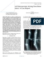 Low Grade Central Osteosarcoma Arising From Bone Infarct A Case Report