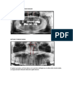 fronterasanatomicas-121017070859-phpapp01