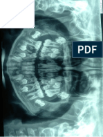 Informe Radiografico de Denticion Mixta