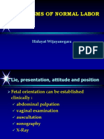 12. Mecanisme_labor in Occiput Presentation (Prof.dr.Hidayat Wijayanegara,Dr.,SpOG)