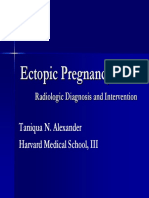 Ectopic Preg PDF