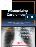 7.Recognizing Cardiomegaly.ppt