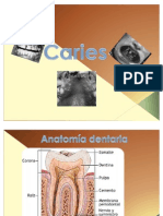 Caries (Office 2007)