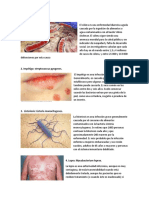 Enfermedades