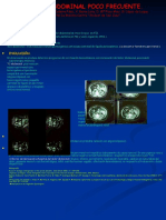 Dolor abdominal poco frecuente