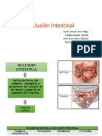 Oclusión intestinal