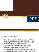 ILEUS