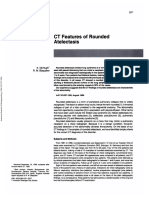 CT Features of Rounded Atelectasis: Findings Were Analyzed and Compared