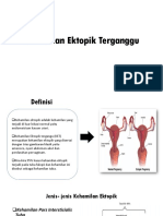 Kehamilan Ektopik Terganggu.pptx