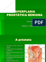 Hiperplasia Prostática Benigna