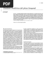 Paralisis Obstetrica Plexo Braquial