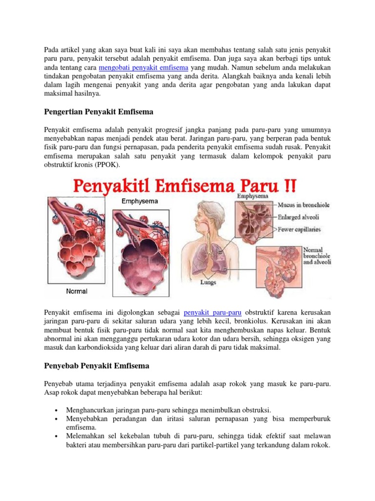 Cara Mengobati Penyakit Emfisema Yang Mudah