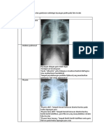 PR Radiologi Rizki Prayuda