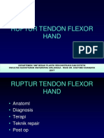 Flexor Tendon Injury 