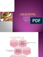 COLECISTITIS