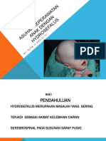 Asuhan Keperawatan Anak Dengan Hydrosefalus