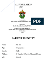 Atrial Fibrilation (AF) : Moh Gilang Fajriansyah Nohu (C11110285)