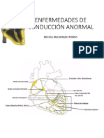 Enfermedades de Conducción Anormal