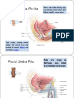 Striktur Uretra