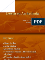 Lesson on Arrhythmia - Charles Hoo,MD
