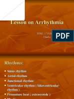 Lesson on arrhythmia - Charles Hoo,MD.ppt
