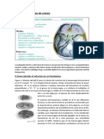 Anatomía de Base de Cráneo