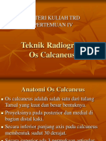 OS CALCANEUS