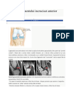 Ruptura Ligamentului Incrucisat Anterior