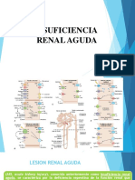 AKI: Insuficiencia Renal Aguda