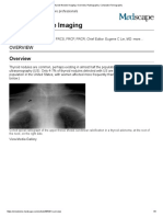 Thyroid Nodule Imaging - Overview, Radiography, Computed Tomography