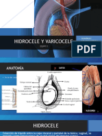 HIDROCELE