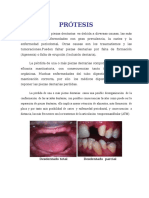 Prótesis Parcial Removible