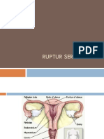 RUPTUR SERVIKSonprocess.pptx