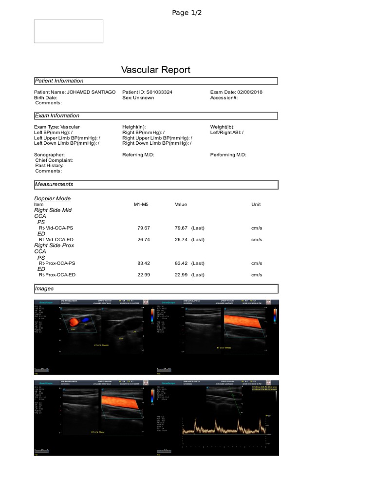 Vascular Exam Report for Johamed Santiago | PDF