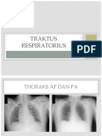 torak patologis 2014