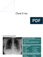 Chest X Ray