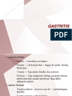 gastritis2.ppt