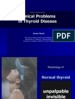 Thyroid Problem Sendomet