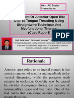 Treatment of Anterior Open Bite Due To Tongue Thrusting Using Straightwire Technique and Myofunctional Therapy (Case Report)