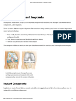 Knee Replacement Implants - OrthoInfo - AAOS