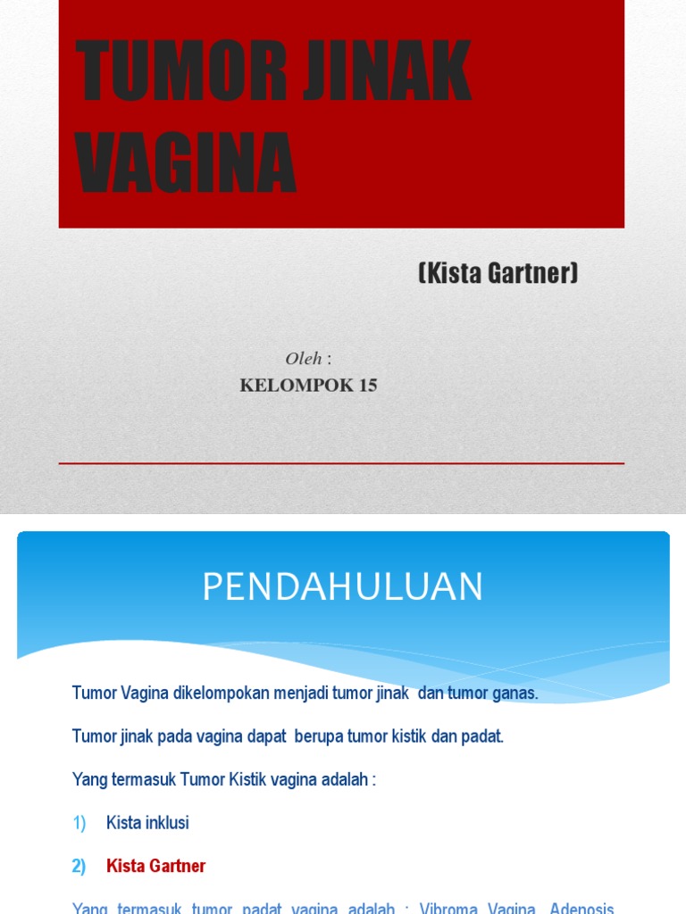 Apa Itu Kista Gejala Penyebab Penaksiran Dan Cara Docdoc