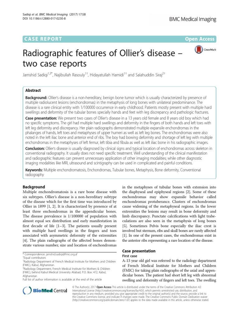 Radiographic Features of Ollier 'S Disease - Two Case Reports | PDF ...